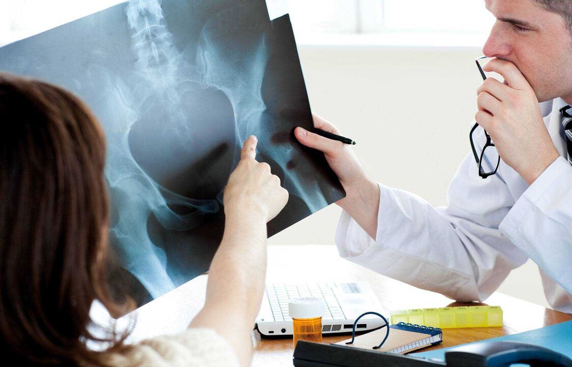 lékaři vyšetřující rentgen na artrózu kyčelního kloubu