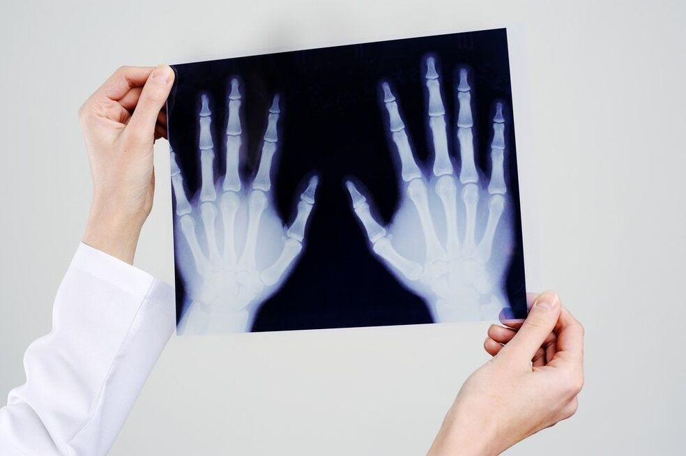 diagnostika kloubů ruky